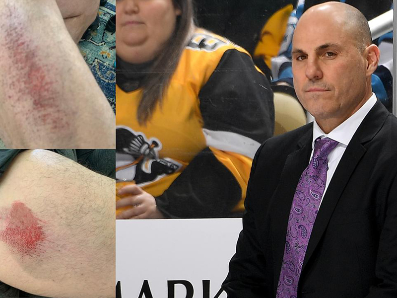 SHORT SHIFT - Tocchet takes tumble while roller skating